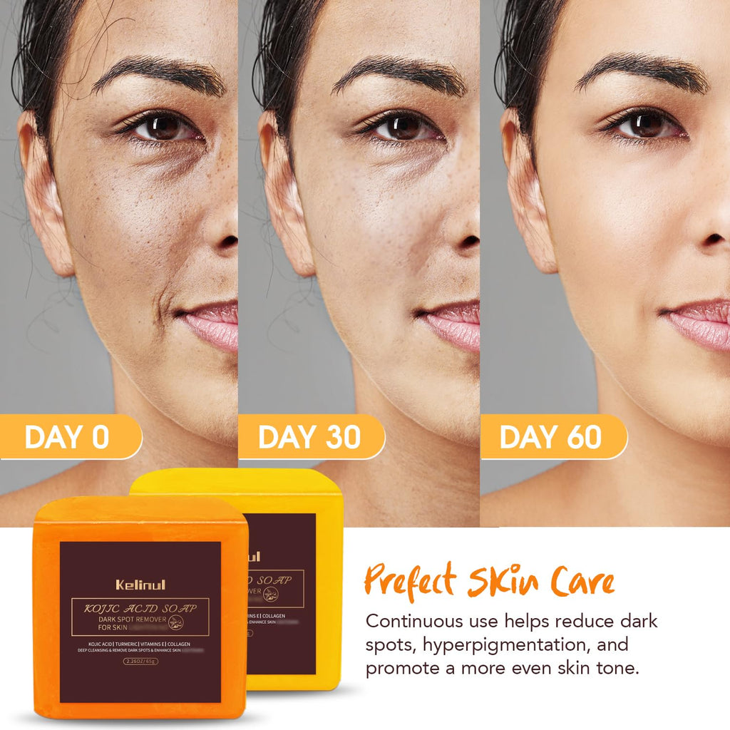 9 OZ 4 Bars Turmeric Soap F82500