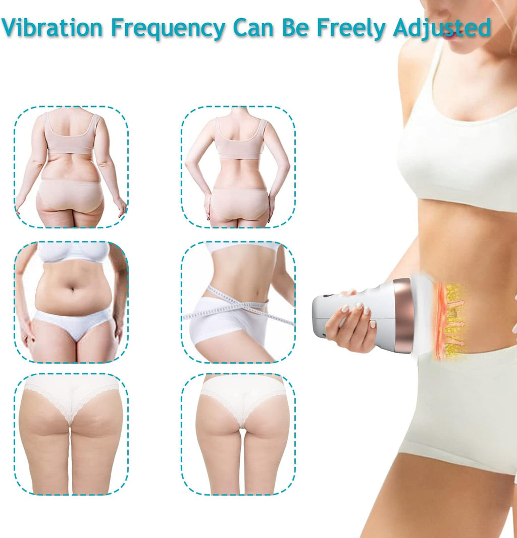 Electric Deep Tissue Cellulite Remover Massager (White) Q772