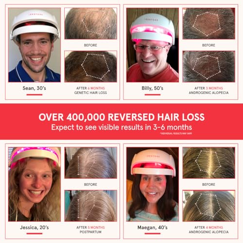FDA Cleared Laser Hair Growth System H103537